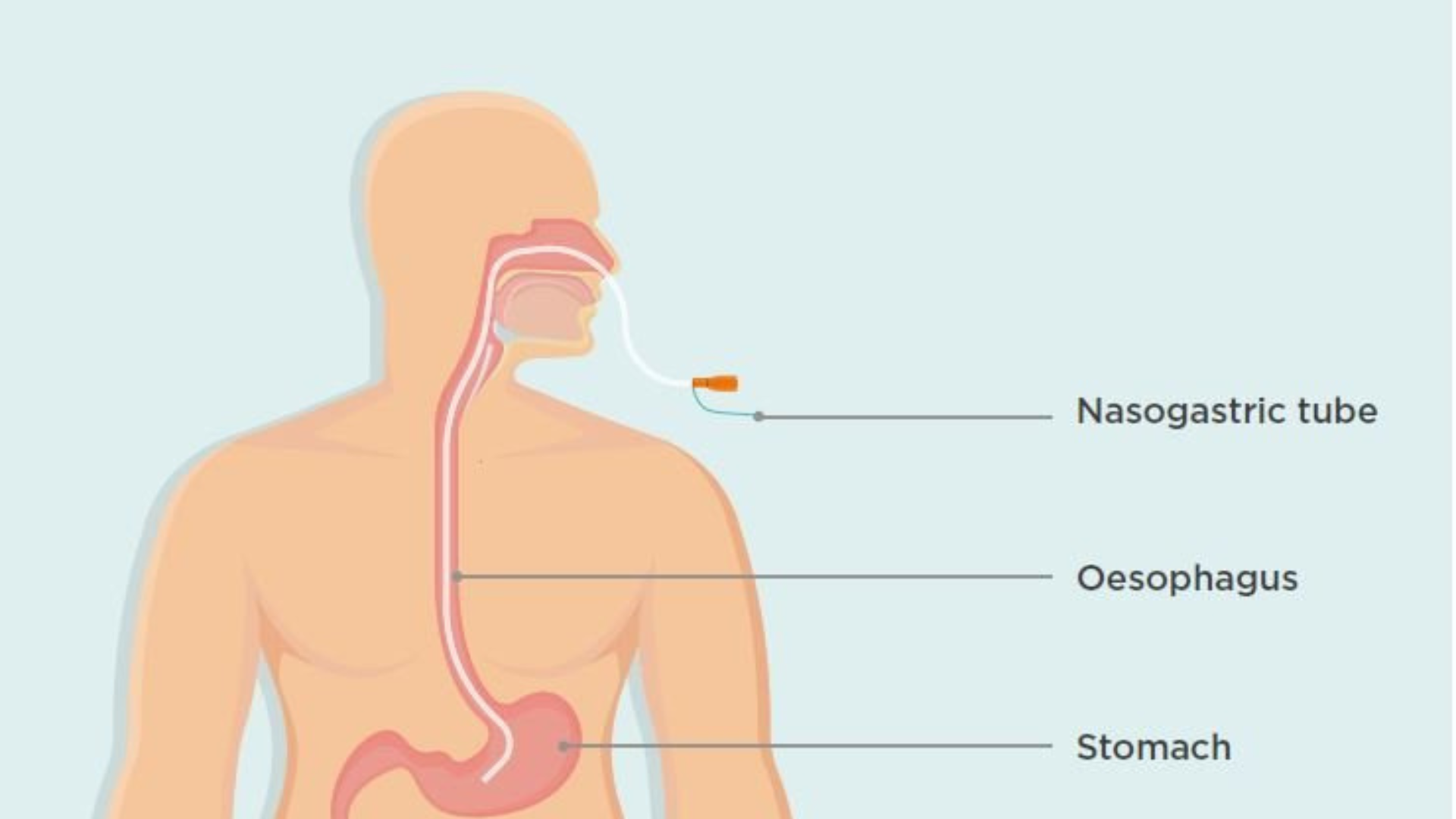 Physiotherapy & Rehabilitation